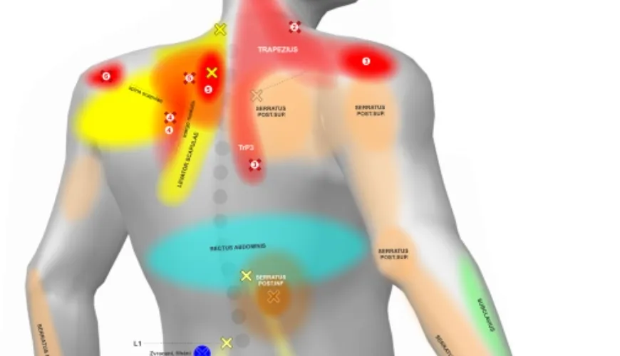 Como entender e tratar dores nas costas com a ajuda de um mapa corporal