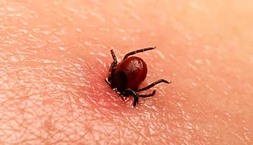 A borreliose pode ocorrer mesmo sem a picada de um carrapato